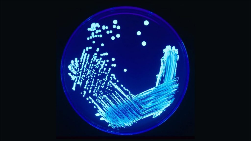 Legionella bacterie